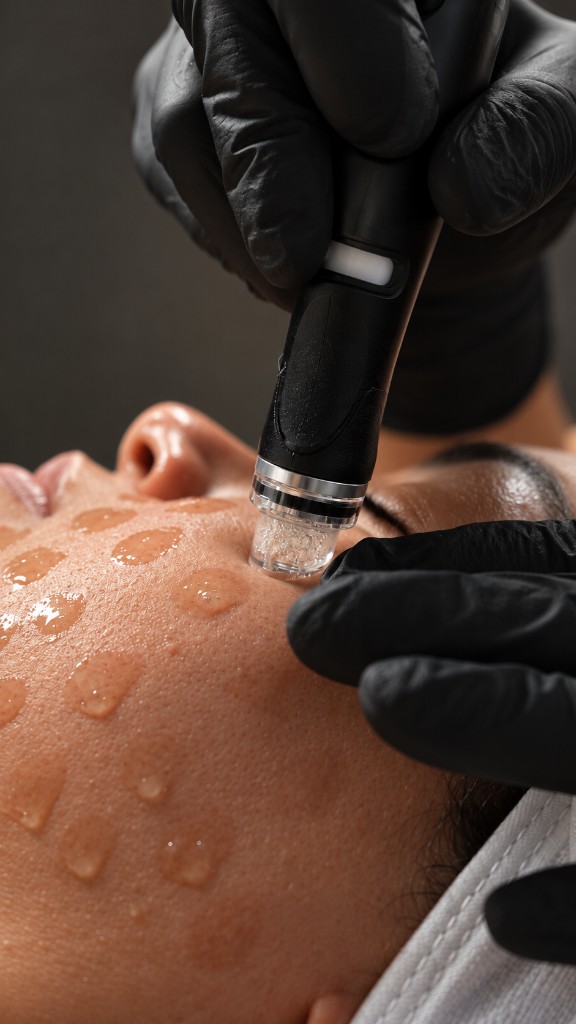 Black gloves holding a microneedling pen